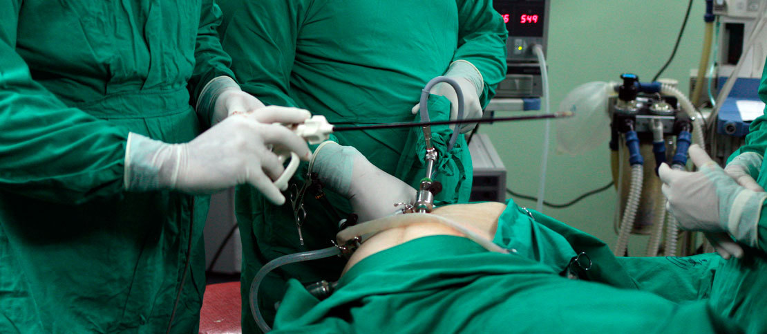 bariatric surgery in Cuba