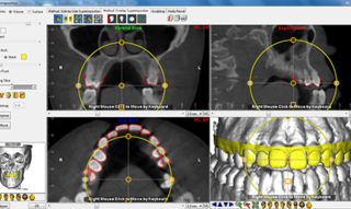 very competitive costs of plastic surgery in Cuba