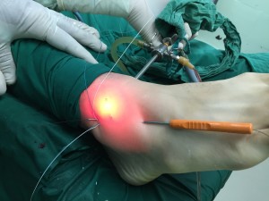 orthopedic implants Cuba